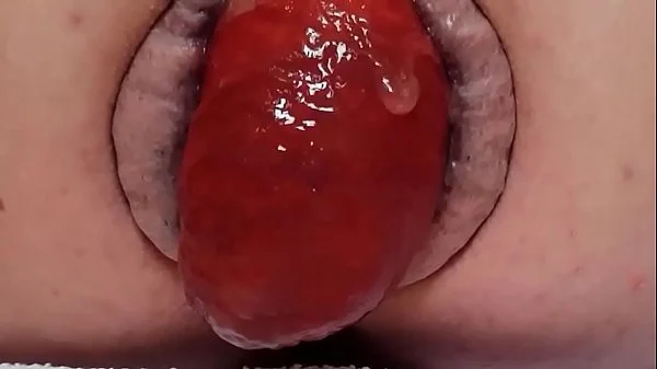 Contender For Biggest Prolapse (Male Warning!)